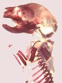 Click for skeletal anomalies.
